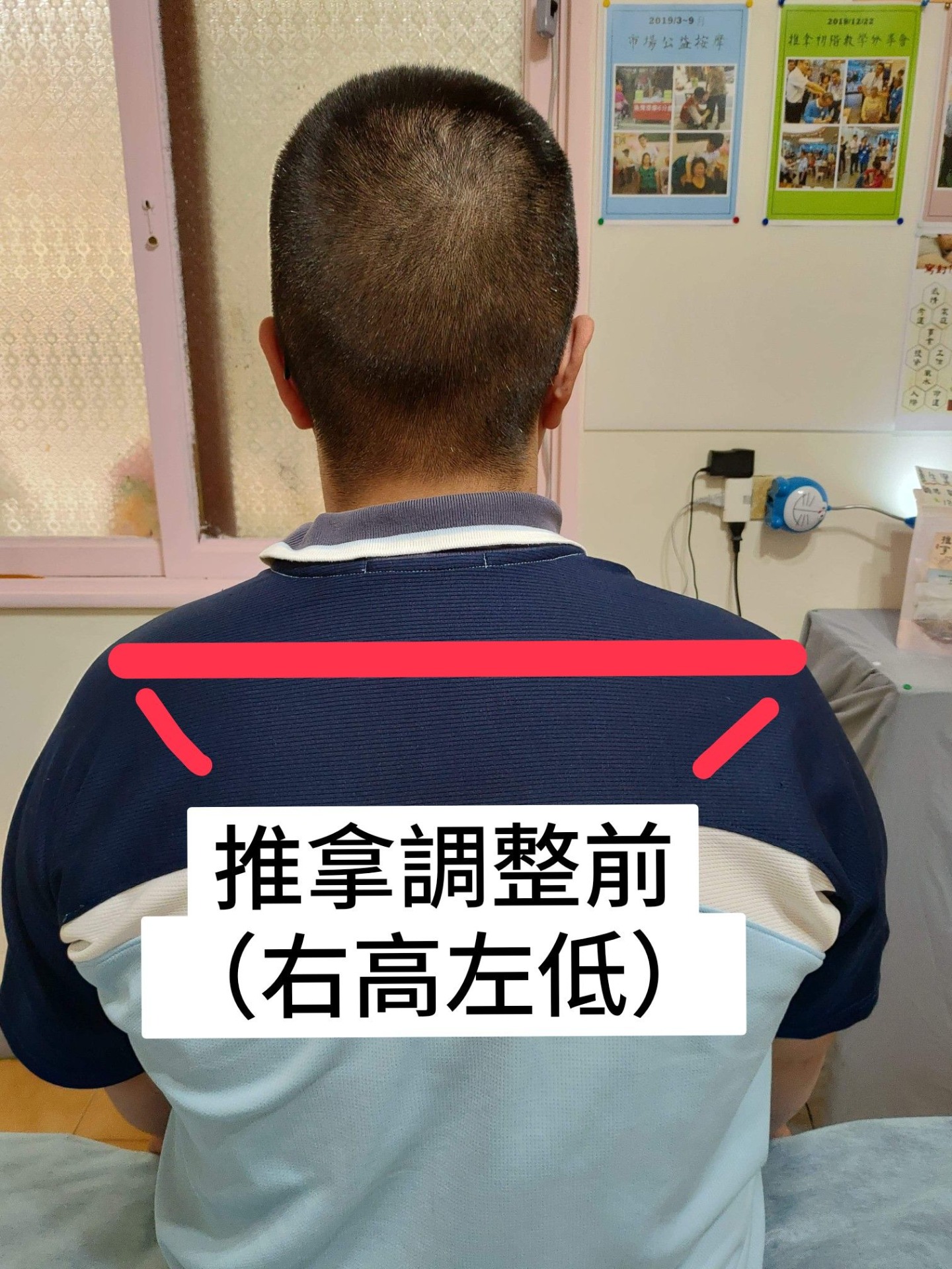 推拿前後對比 10