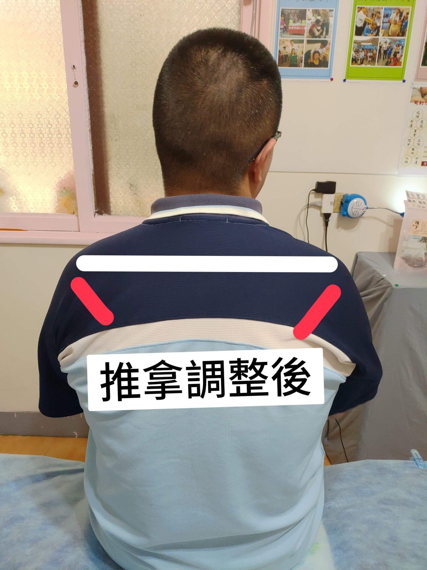 推拿前後對比 11