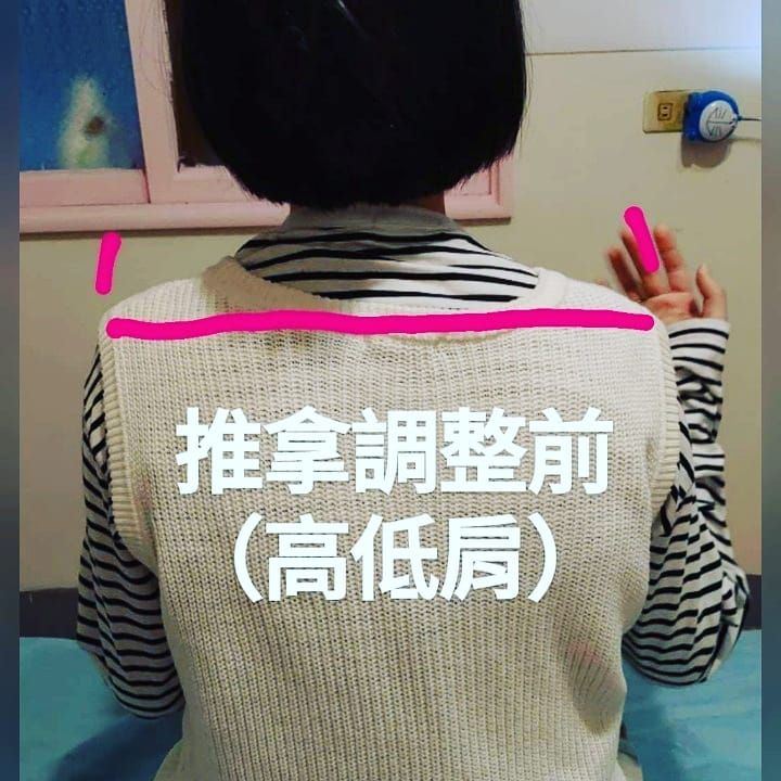 推拿前後對比 3
