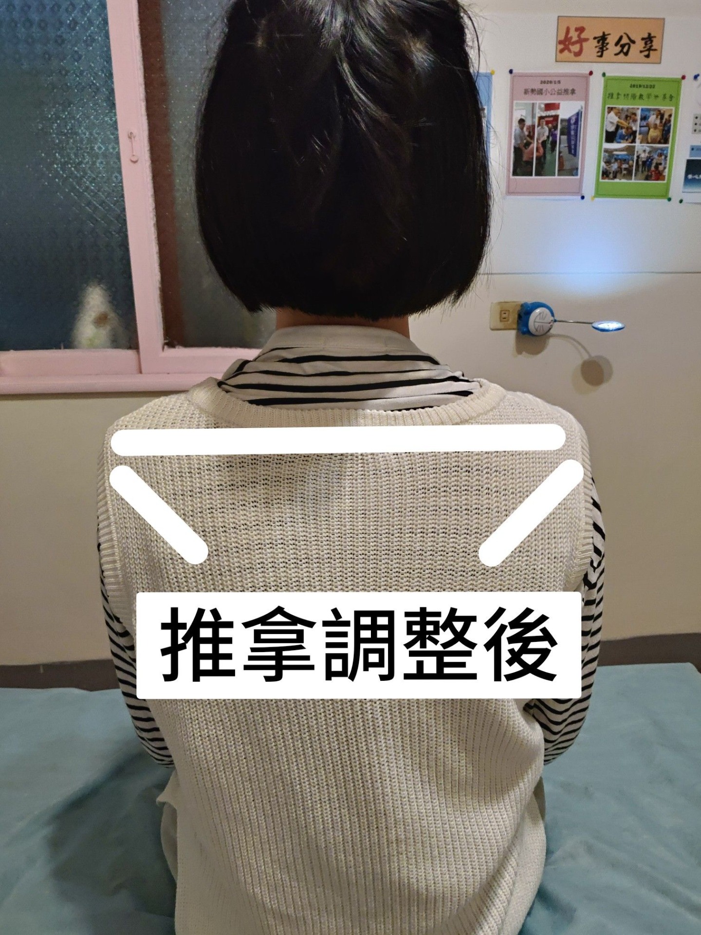 推拿前後對比 4